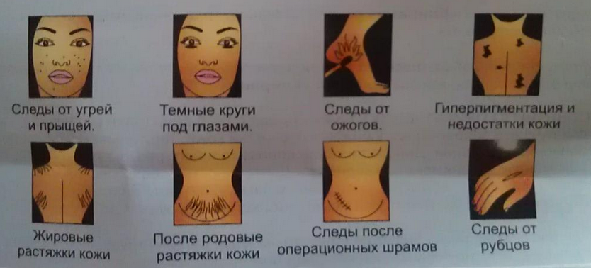 tac dung cua kem lien seo Klivrin