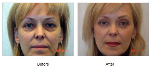 Fairfood nơi bạn tìm thấy những gì tinh túy của tự nhiên 