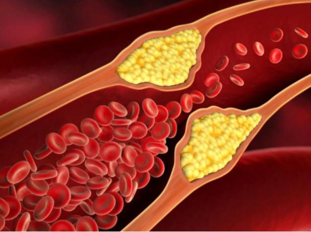 xo vua dong mach va taxifolin