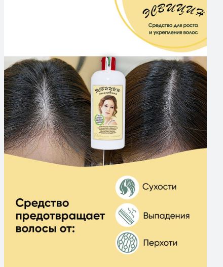 esvisin kich thich moc toc chong rung toc cua nga