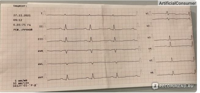 review ve vien uong chong dot quy, tai bien mach mau nao, bo tim Cardiomagnyl Nga huyet khoi1